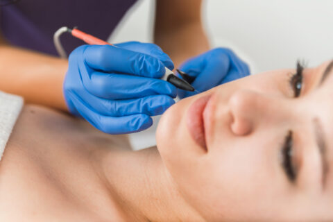 Advanced Electrolysis – Hair & Skin