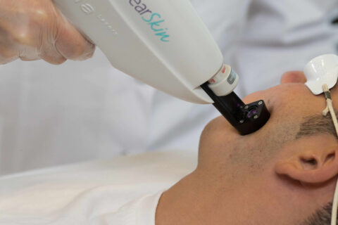 Dark Spot Removal