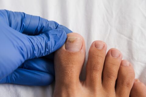 Chiropody